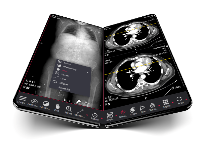 Dicom-Viewer-MedDream-foldable-mobile-web